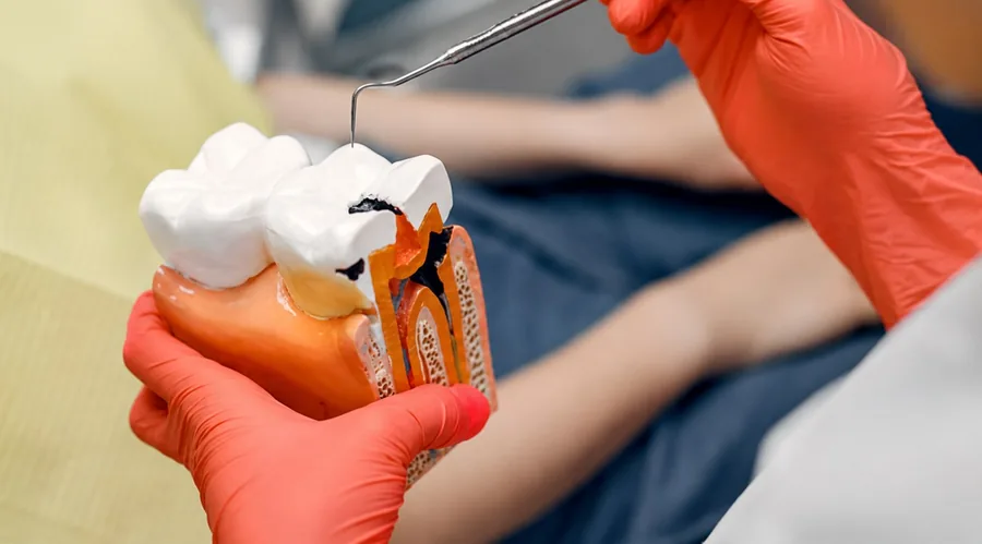 Endodoncia (tratamiento de conductos)